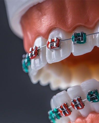 Orthodontics Case